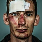 a man with a bandaged eye and a piece of paper on his forehead